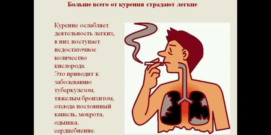 Основное изображение для события Беседа «Курение — опасно для жизни»